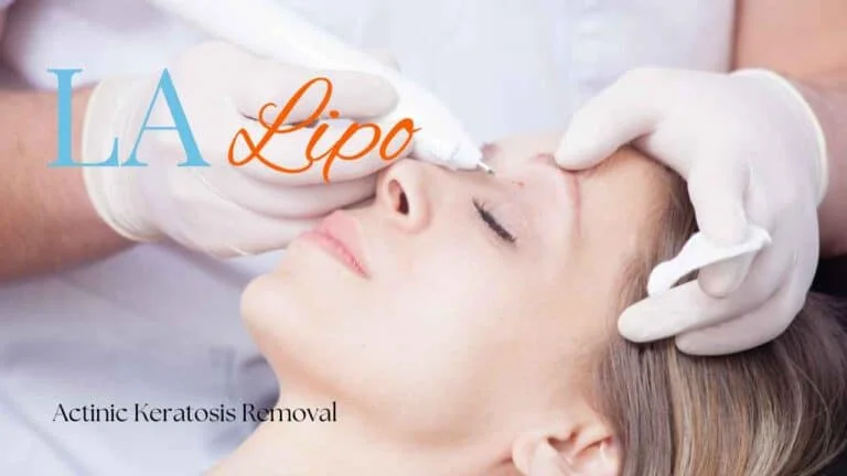 Woman receiving Actinic Keratosis Removal Treatment Marlow