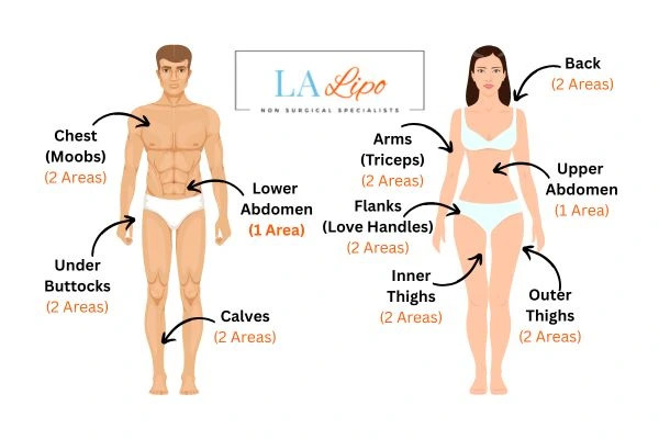 LA LIPO Cryolipolysis Areas Marlow