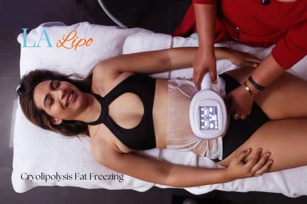 woman getting cryolipolysis Marlow