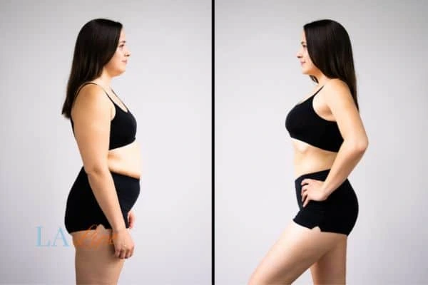 Picture of womans before and after using LA-EMS body sculpting to improve her core strength Marlow
