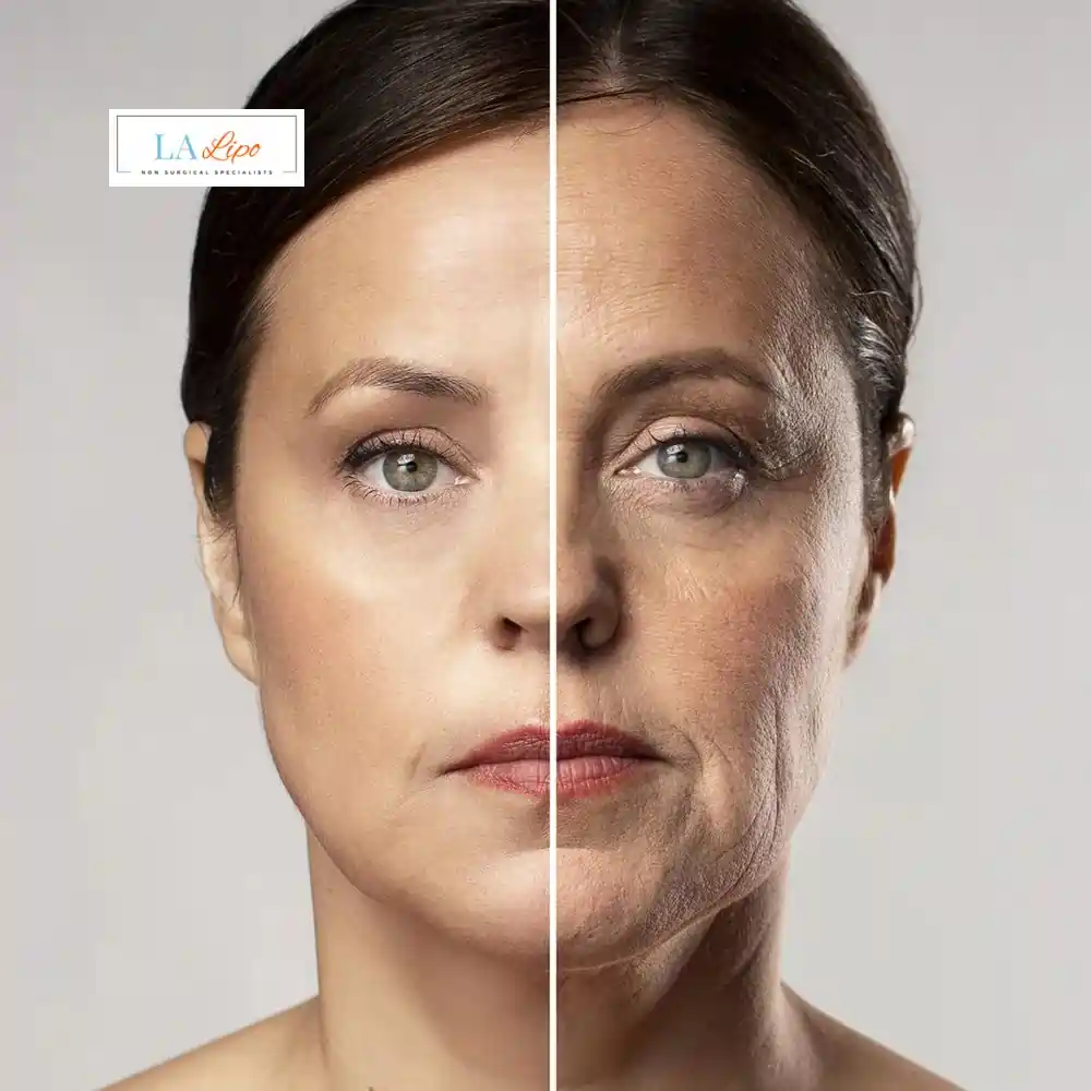How Can You Tell If Non-Surgical Skin Tightening Is Right for You Marlow?