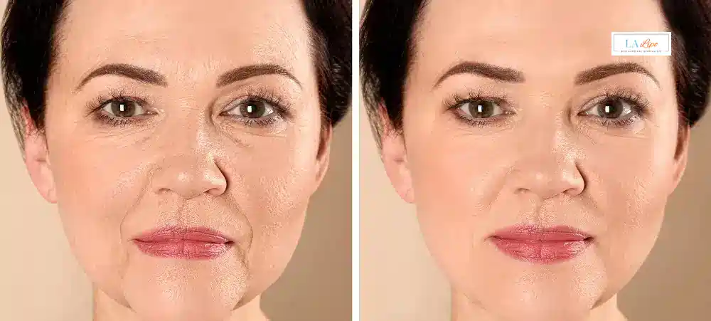 How Long Does It Take to See Results and How Long Do They Last Marlow?