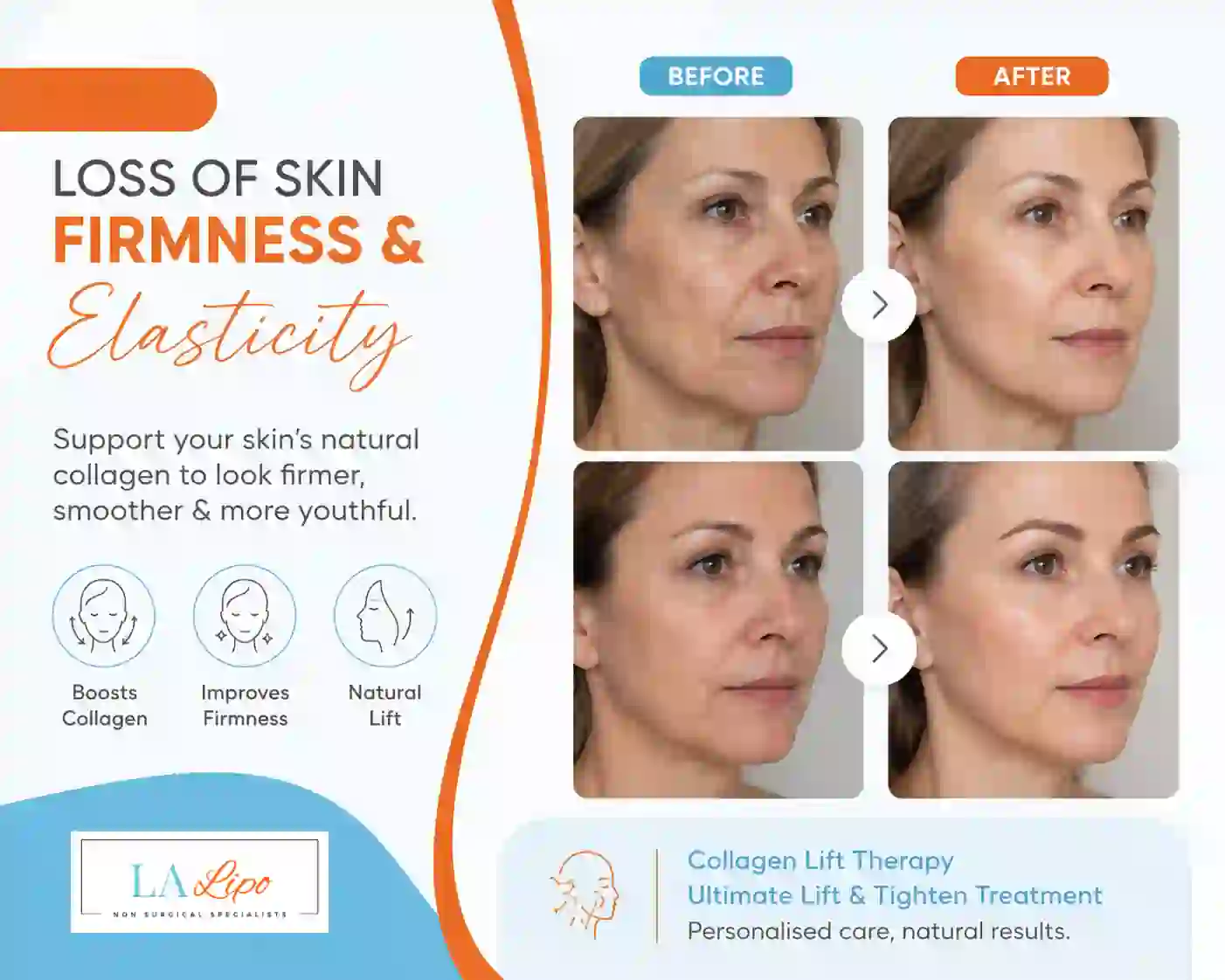 Sign #7: Loss of Skin Firmness and Elasticity Marlow