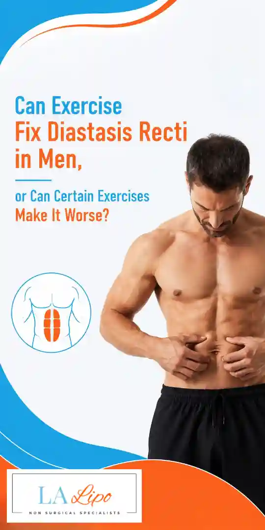 Can Exercise Fix Diastasis Recti in Men, or Can Certain Exercises Make It Worse Marlow?