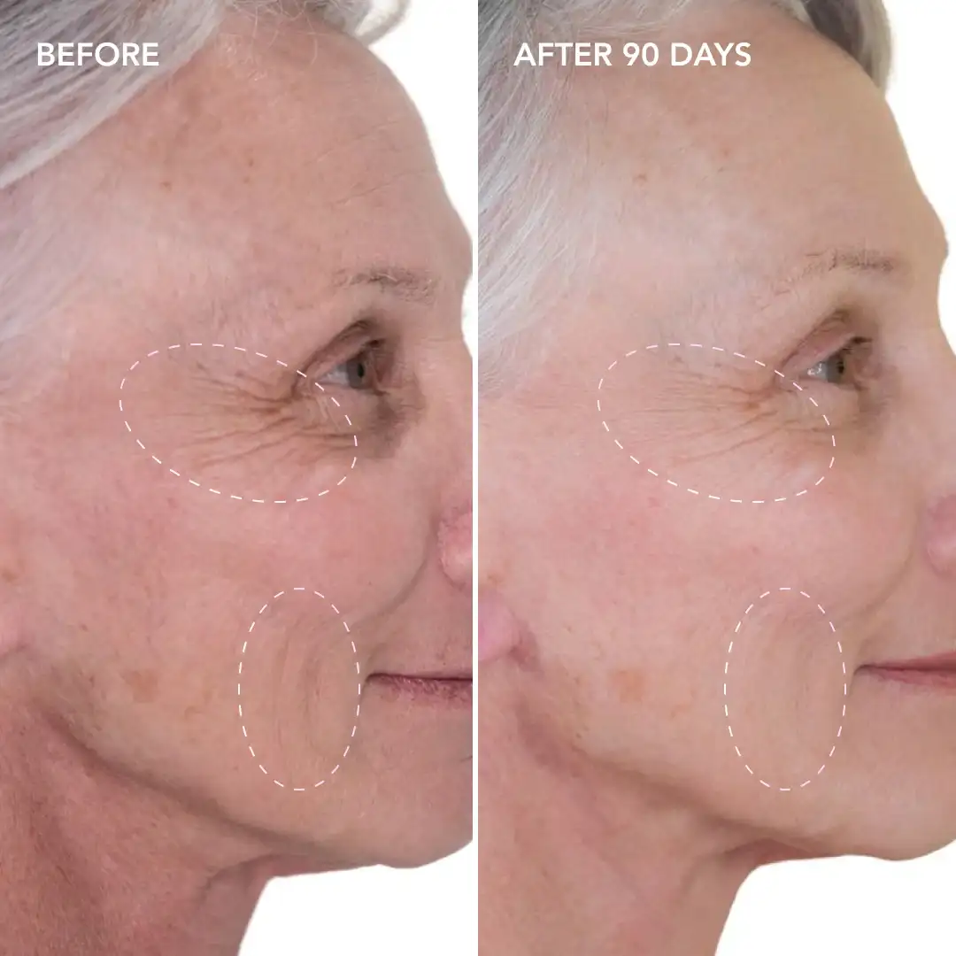 When will you see results Marlow